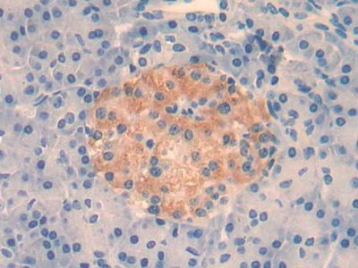Immunohistochemistry (Formalin/PFA-fixed paraffin-embedded sections) - Anti-IL-4 antibody [C1] (AB239508), expandable thumbnail