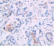 Immunohistochemistry (Formalin/PFA-fixed paraffin-embedded sections) - Anti-IL-4 antibody [C1] (AB239508), expandable thumbnail