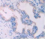 Immunohistochemistry (Formalin/PFA-fixed paraffin-embedded sections) - Anti-IL-4 antibody [C1] (AB239508)