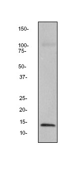 Western blot - Anti-IL-4 antibody [EPR1118Y] (AB62351), expandable thumbnail