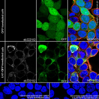 Immunocytochemistry/ Immunofluorescence - Anti-IL-4I1/LAO antibody [EPR22070] (AB222102)