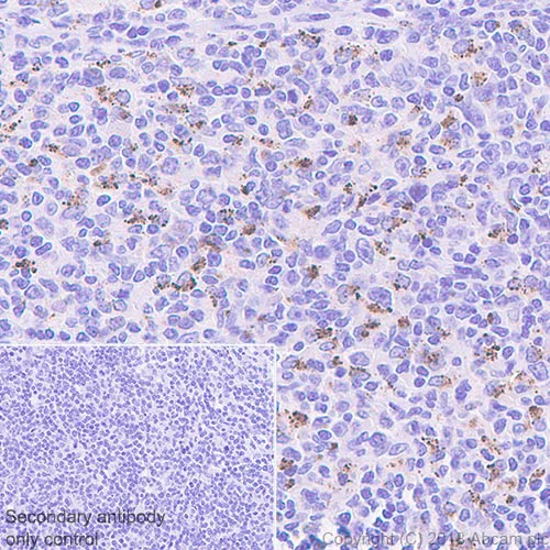 Immunohistochemistry (Formalin/PFA-fixed paraffin-embedded sections) - Anti-IL-4I1/LAO antibody [EPR22070] (AB222102)