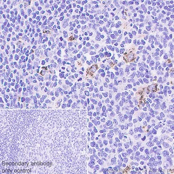 Immunohistochemistry (Formalin/PFA-fixed paraffin-embedded sections) - Anti-IL-4I1/LAO antibody [EPR22070] - BSA and Azide free (AB237783)
