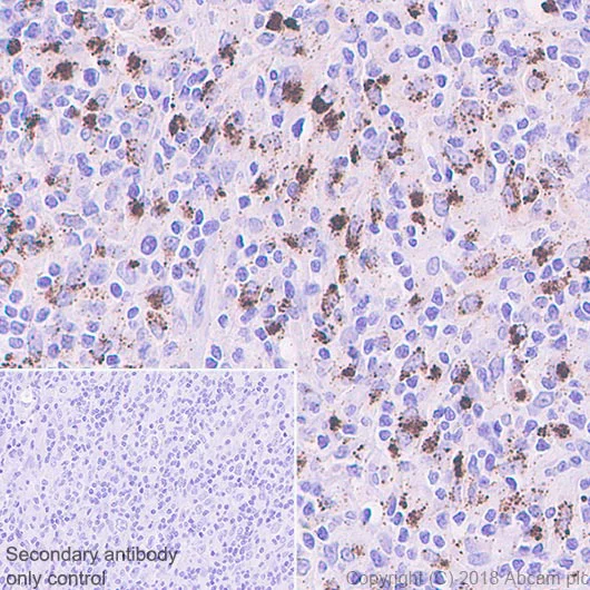 Immunohistochemistry (Formalin/PFA-fixed paraffin-embedded sections) - Anti-IL-4I1/LAO antibody [EPR22070] - BSA and Azide free (AB237783)