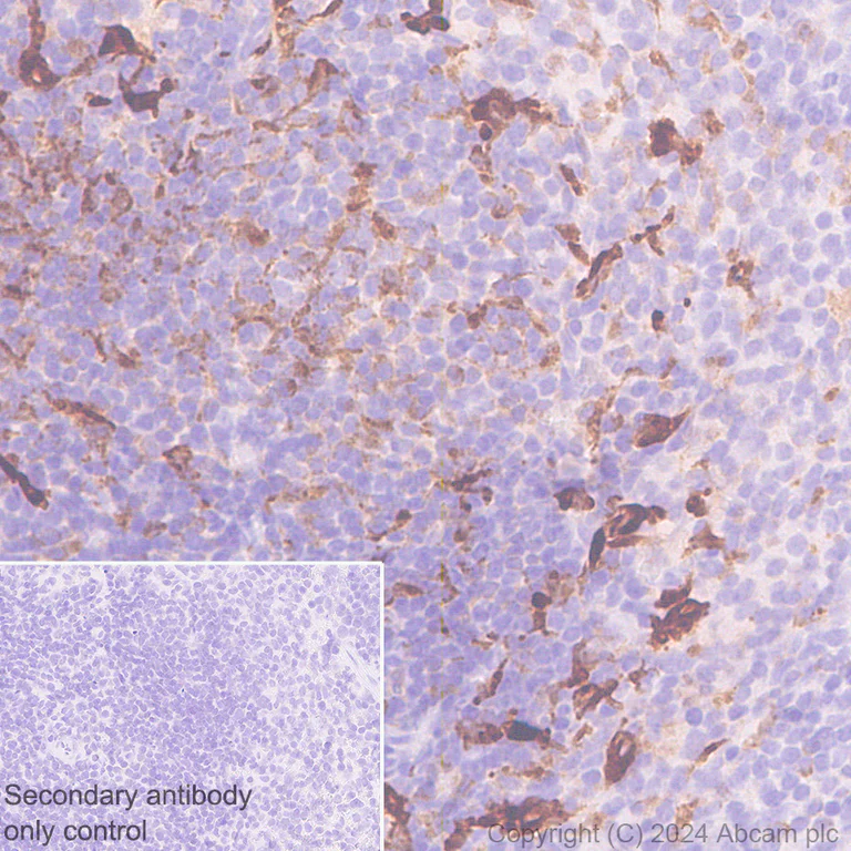 Immunohistochemistry (Formalin/PFA-fixed paraffin-embedded sections) - Anti-IL-4I1/LAO antibody [EPR26368-90] (AB317248)