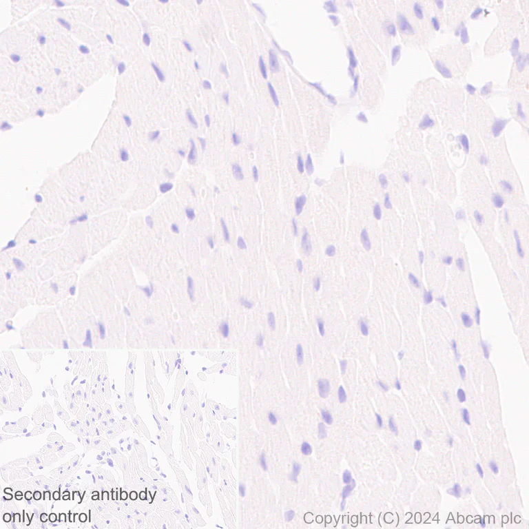 Immunohistochemistry (Formalin/PFA-fixed paraffin-embedded sections) - Anti-IL-4I1/LAO antibody [EPR26368-90] (AB317248)