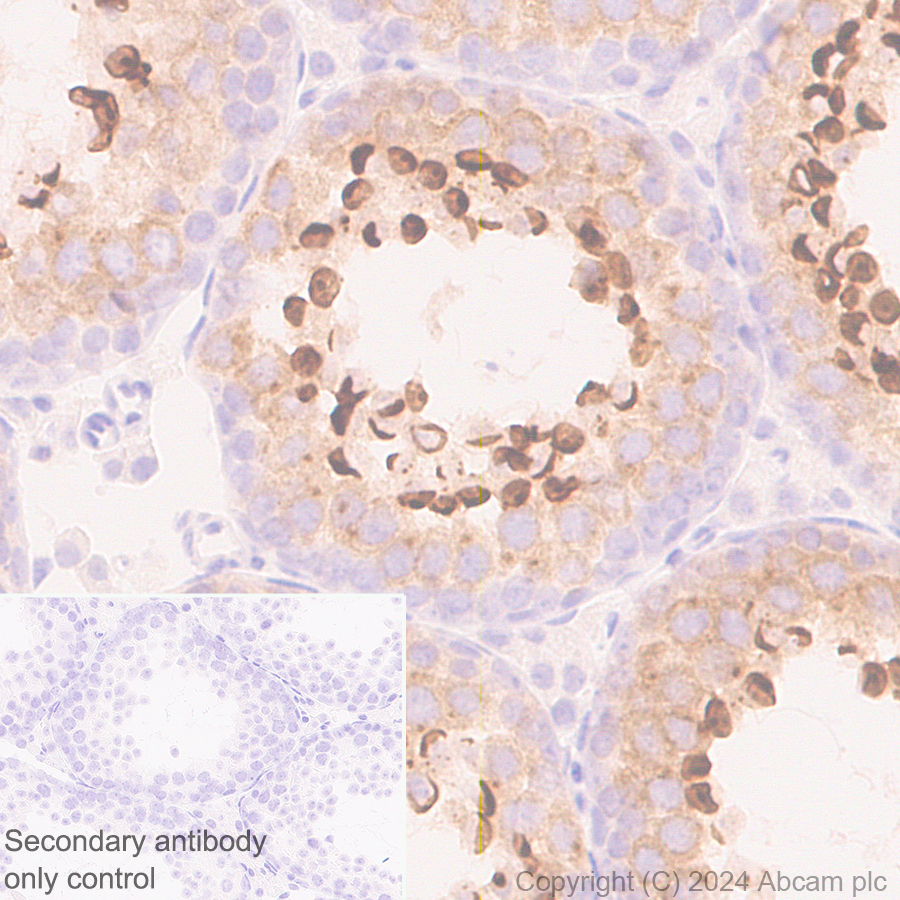 Immunohistochemistry (Formalin/PFA-fixed paraffin-embedded sections) - Anti-IL-4I1/LAO antibody [EPR26368-90] - BSA and Azide free (AB317249), expandable thumbnail