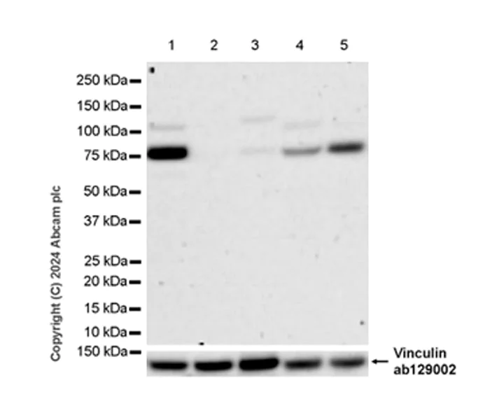 Western blot - Anti-IL-4I1/LAO antibody [EPR26368-90] - BSA and Azide free (AB317249)