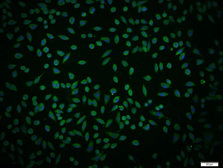 Immunocytochemistry/ Immunofluorescence - Anti-IL-4R antibody (AB203398)