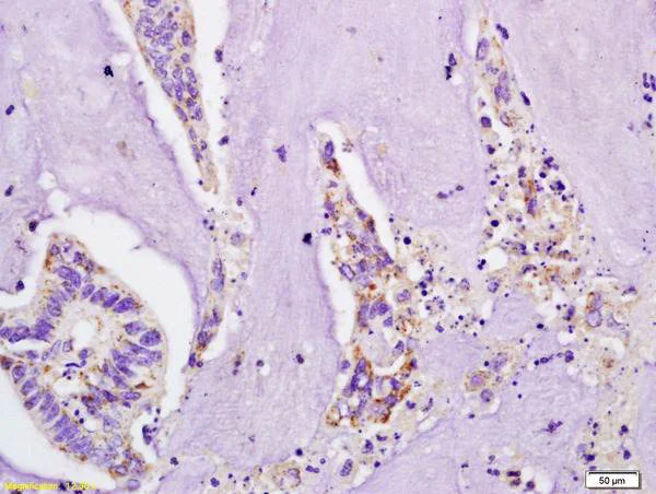 Immunohistochemistry (Formalin/PFA-fixed paraffin-embedded sections) - Anti-IL-4R antibody (AB203398)