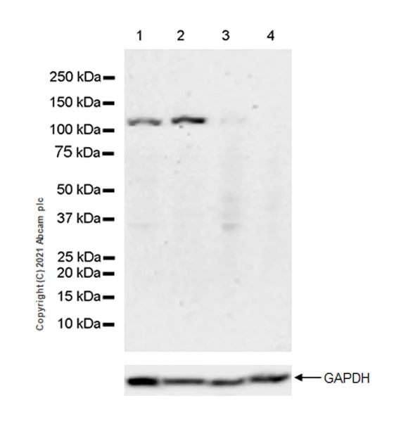 Western blot - Anti-IL-4R antibody [EPR23671-21] - BSA and Azide free (AB288306)
