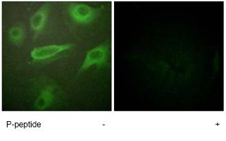 Immunocytochemistry/ Immunofluorescence - Anti-IL-4R (phospho Y497) antibody (AB61099)