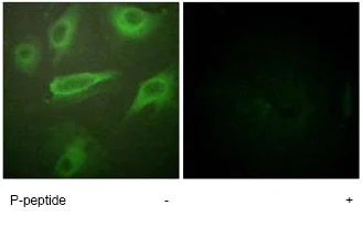 Immunocytochemistry/ Immunofluorescence - Anti-IL-4R (phospho Y497) antibody (AB61099)