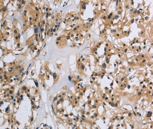 Immunohistochemistry (Formalin/PFA-fixed paraffin-embedded sections) - Anti-IL-5RA antibody - C-terminal (AB198808)
