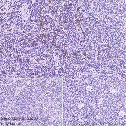 Immunohistochemistry (Formalin/PFA-fixed paraffin-embedded sections) - Anti-IL-5RA antibody [CAL40] (AB237716)