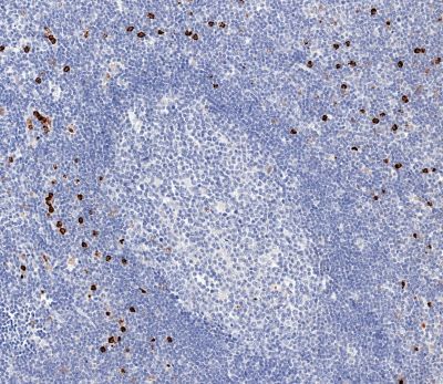Immunohistochemistry (Formalin/PFA-fixed paraffin-embedded sections) - Anti-IL-5RA antibody [CAL40] (AB237716)