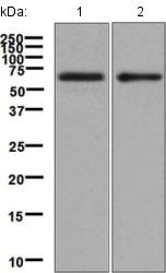 Western blot - Anti-IL-5RA antibody [EPR5450(2)] (AB134935), expandable thumbnail