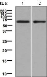 Western blot - Anti-IL-5RA antibody [EPR5450(2)] - BSA and Azide free (AB248740)