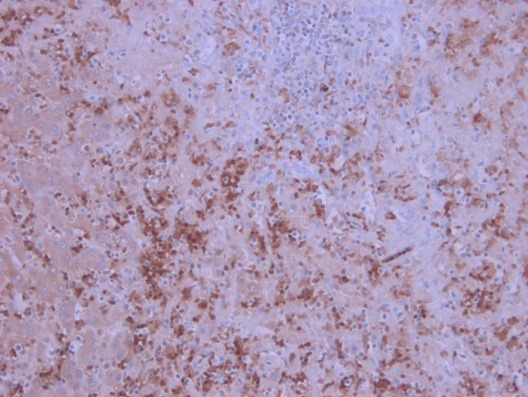 Immunohistochemistry (Formalin/PFA-fixed paraffin-embedded sections) - Anti-IL-6 antibody [1.2-2B11-2G10] (AB9324)