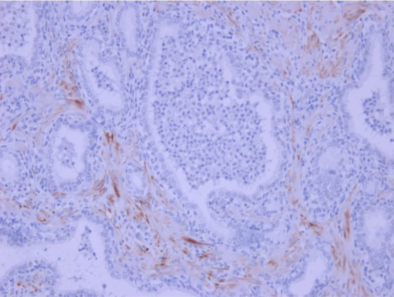 Immunohistochemistry (Formalin/PFA-fixed paraffin-embedded sections) - Anti-IL-6 antibody [1.2-2B11-2G10] (AB9324)