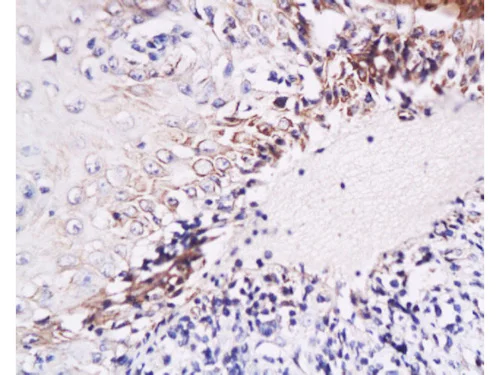 Immunohistochemistry (Formalin/PFA-fixed paraffin-embedded sections) - Anti-IL-6 antibody (AB216492)