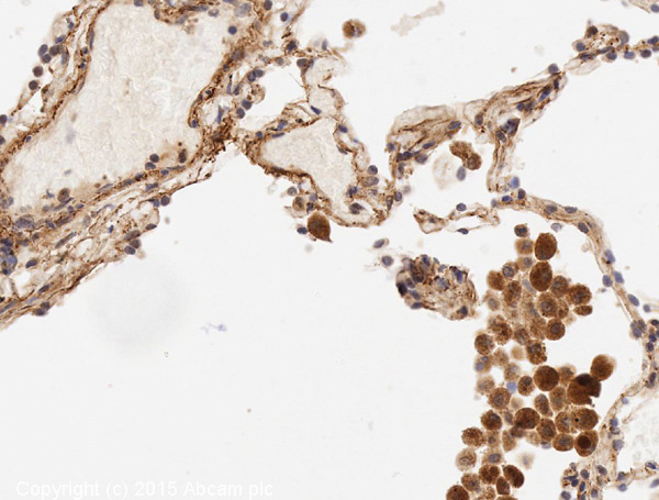Immunohistochemistry (Formalin/PFA-fixed paraffin-embedded sections) - Anti-IL-6 antibody (AB6672), expandable thumbnail