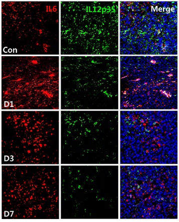 Immunohistochemistry (Formalin/PFA-fixed paraffin-embedded sections) - Anti-IL-6 antibody (AB6672), expandable thumbnail