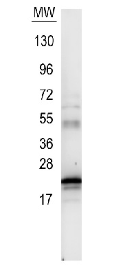 Western blot - Anti-IL-6 antibody (AB6672), expandable thumbnail