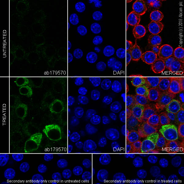 Immunocytochemistry/ Immunofluorescence - Anti-IL-6 antibody [EPR16610-69] - BSA and Azide free (AB245828)