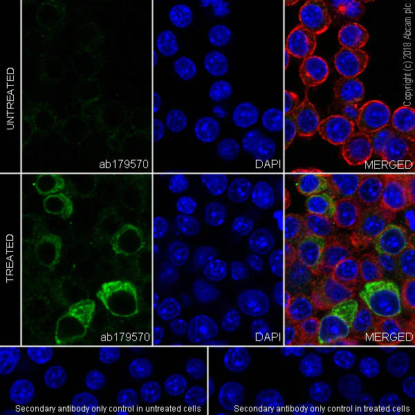 Immunocytochemistry/ Immunofluorescence - Anti-IL-6 antibody [EPR16610-69] - BSA and Azide free (AB245828)