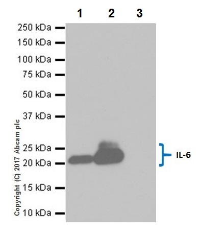 Immunoprecipitation - Anti-IL-6 antibody [EPR20653] (AB214429), expandable thumbnail