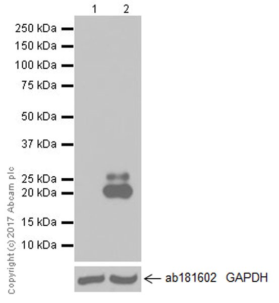 Western blot - Anti-IL-6 antibody [EPR20653] (AB214429), expandable thumbnail