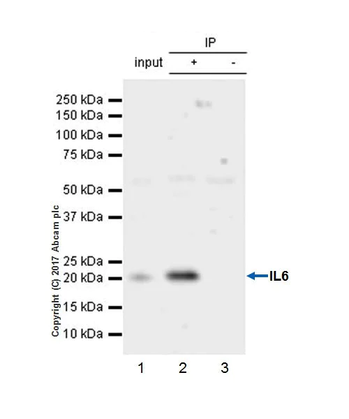 Immunoprecipitation - Anti-IL-6 antibody [EPR21710] (AB229381)