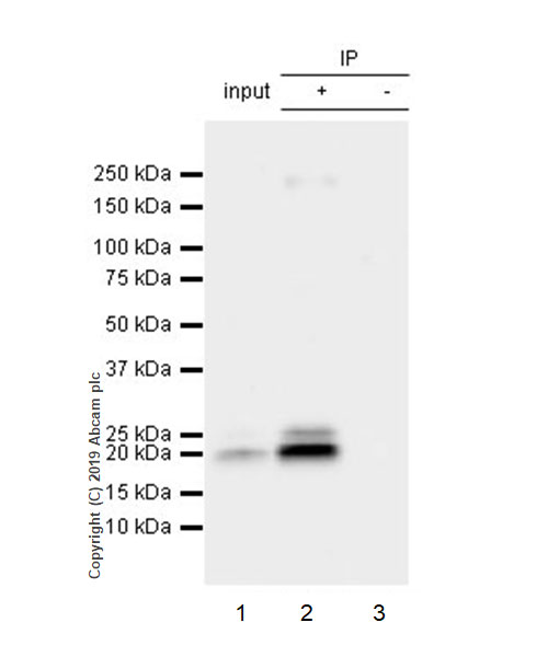 Immunoprecipitation - Anti-IL-6 antibody [EPR22565-204] (AB233551), expandable thumbnail