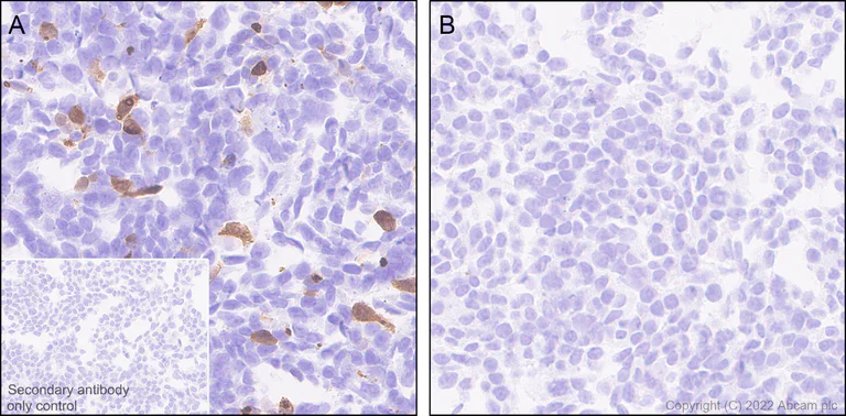 Immunohistochemistry (Formalin/PFA-fixed paraffin-embedded sections) - Anti-IL-6 antibody [EPR23819-103] - BSA and Azide free (AB290750)
