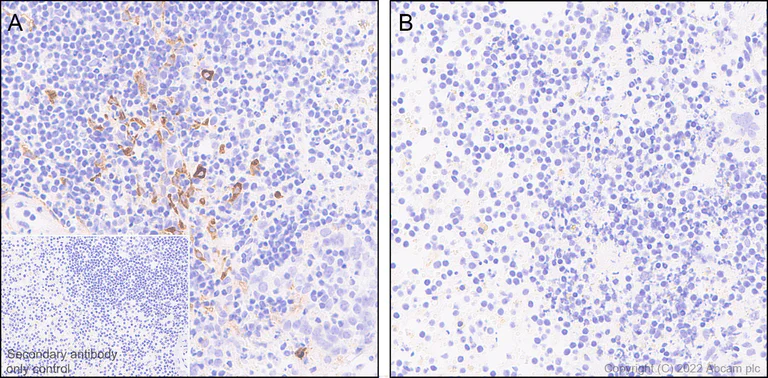 Immunohistochemistry (Formalin/PFA-fixed paraffin-embedded sections) - Anti-IL-6 antibody [EPR23819-103] - BSA and Azide free (AB290750)