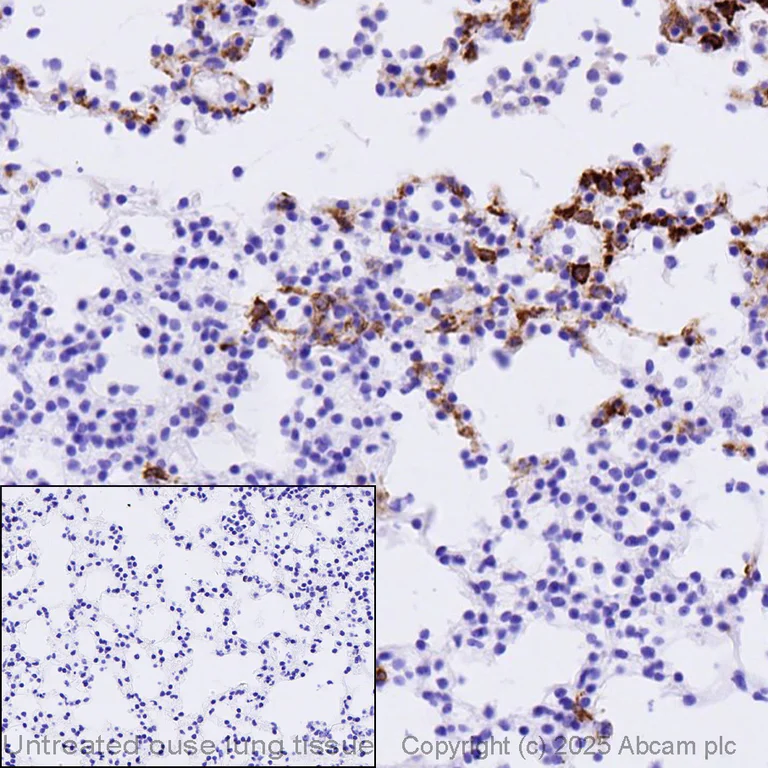 Immunohistochemistry (Formalin/PFA-fixed paraffin-embedded sections) - Anti-IL-6 antibody [EPR23819-103] - BSA and Azide free (AB290750)