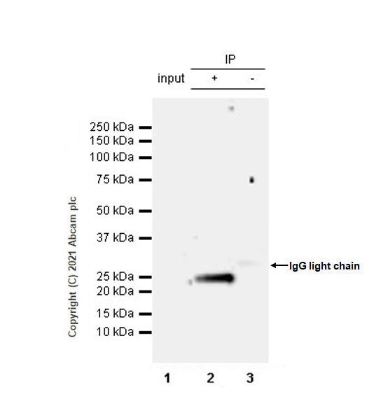 Immunoprecipitation - Anti-IL-6 antibody [EPR23819-11] (AB259341), expandable thumbnail