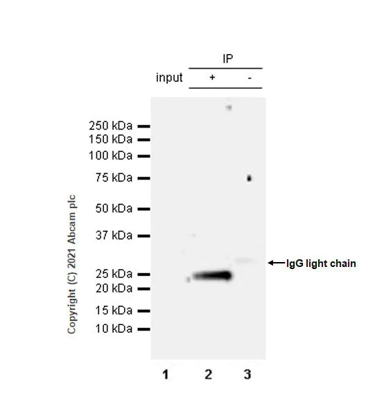 Immunoprecipitation - Anti-IL-6 antibody [EPR23819-11] (AB259341)