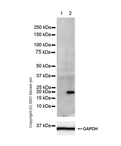 Western blot - Anti-IL-6 antibody [EPR23819-11] (AB259341), expandable thumbnail