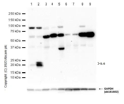 Western blot - Anti-IL-6 antibody [EPR23819-11] - BSA and Azide free (AB281935)