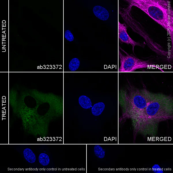 Immunocytochemistry/ Immunofluorescence - Anti-IL-6- antibody [EPRNGS_IL-6-20] BSA and Azide free, low endotoxin (AB323372)