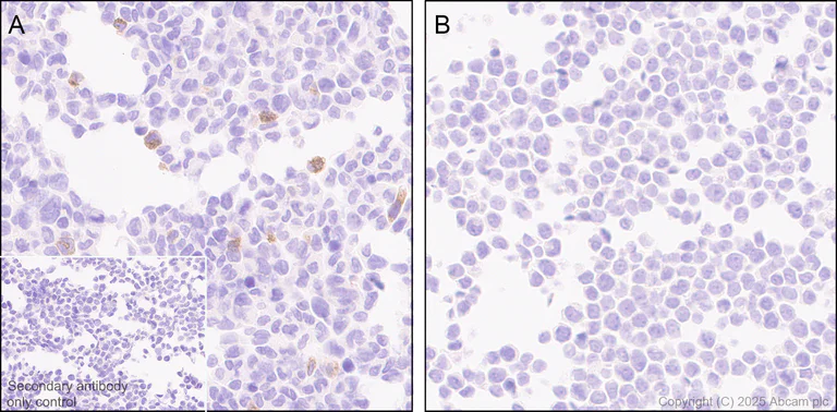 Immunohistochemistry (Formalin/PFA-fixed paraffin-embedded sections) - Anti-IL-6 antibody [RM1304] (AB324449)