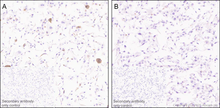 Immunohistochemistry (Formalin/PFA-fixed paraffin-embedded sections) - Anti-IL-6 antibody [RM1304] (AB324449)