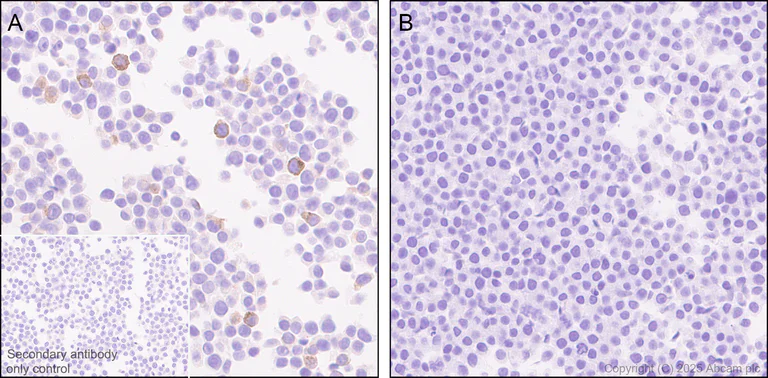 Immunohistochemistry (Formalin/PFA-fixed paraffin-embedded sections) - Anti-IL-6 antibody [RM1304] (AB324449)