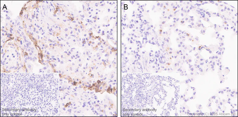 Immunohistochemistry (Formalin/PFA-fixed paraffin-embedded sections) - Anti-IL-6 antibody [RM1304] (AB324449)