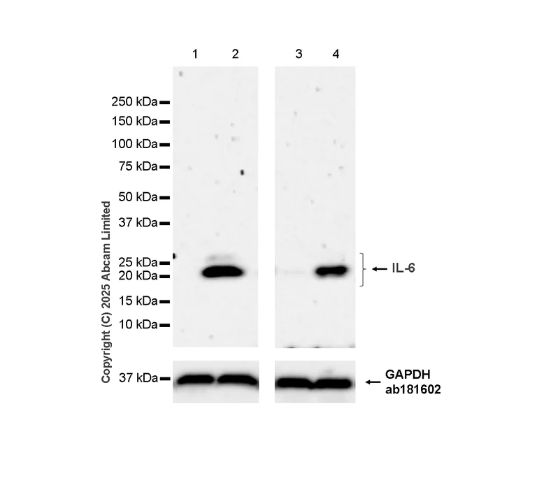 Western blot - Anti-IL-6 antibody [RM1304] (AB324449)