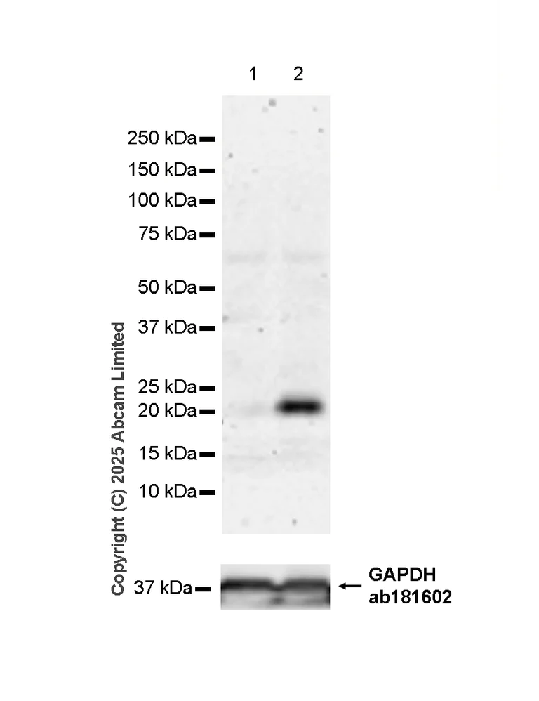 Western blot - Anti-IL-6 antibody [RM1304] (AB324449)