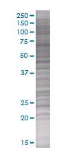 IL-6 overexpression 293T lysate (whole cell)
