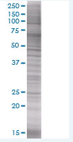 IL-6 overexpression 293T lysate (whole cell)